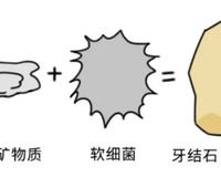 每天认真刷牙，为什么医生还是建议你洗牙？