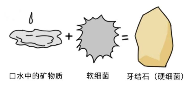 洁牙素材-口中污渍