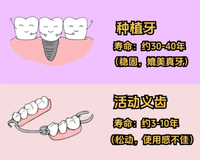 种植牙全攻略：从原理到术后，一篇讲清楚